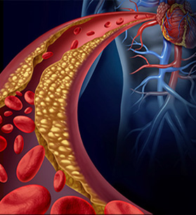 ���XѪ��ˎ��